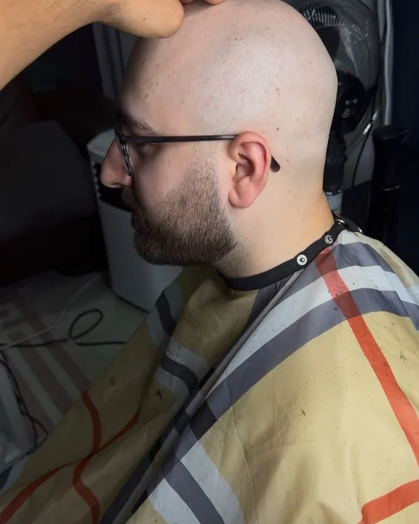 Kaal geschoren met baardlijn bij Akcutz